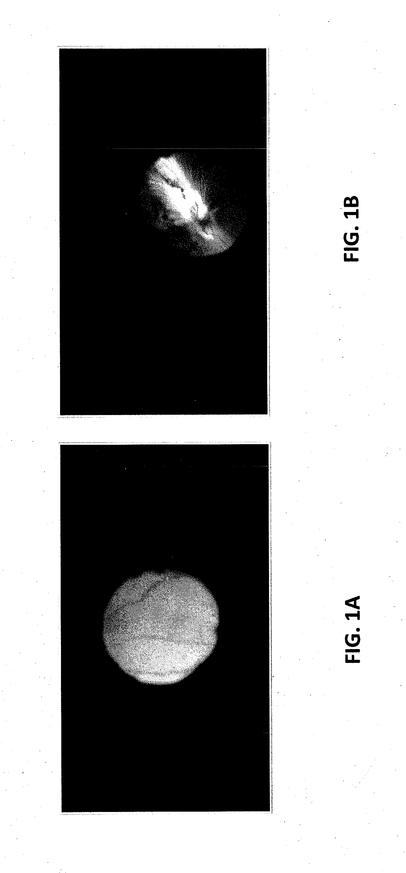 Augmented field of view imaging system