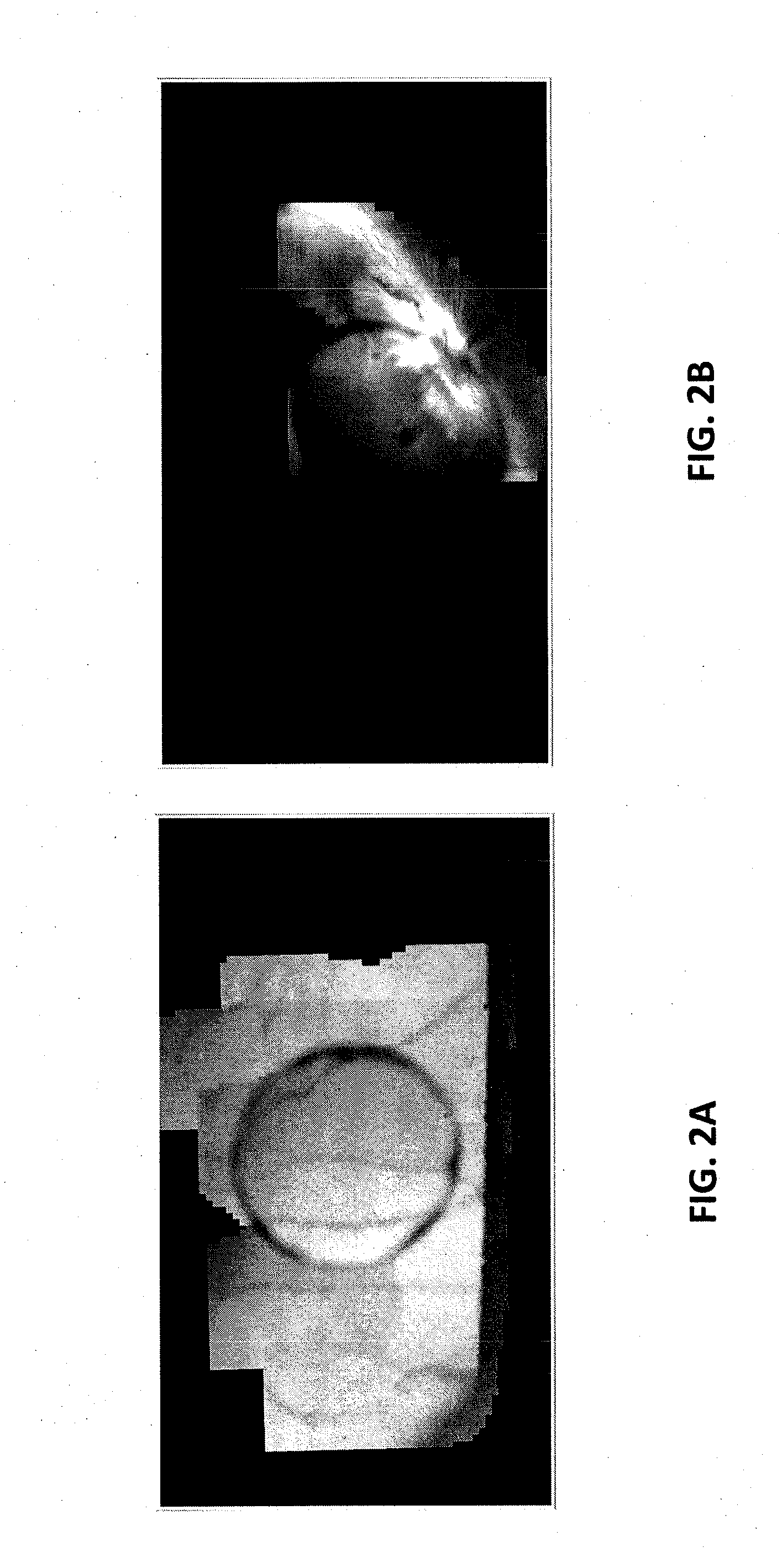 Augmented field of view imaging system