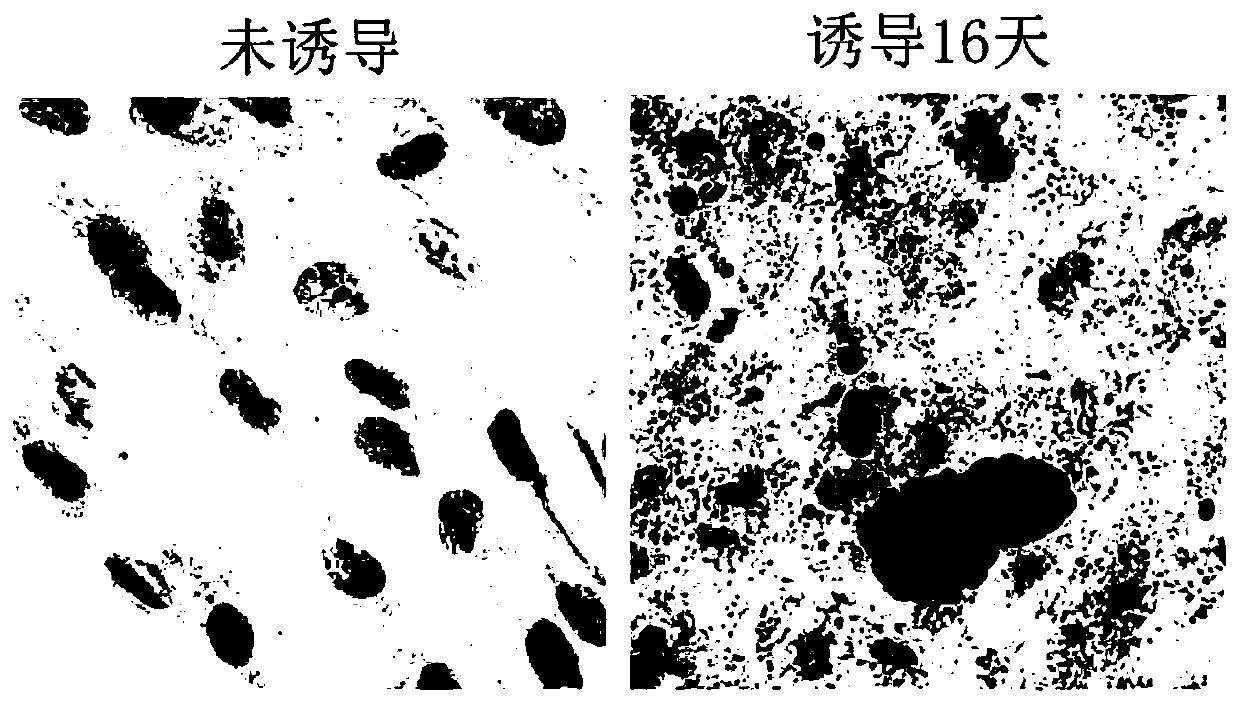 Method for inducing human skin fibroblasts to differentiate into adipocytes in vitro