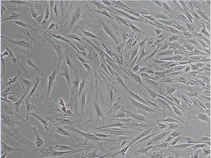 Rapid extraction method of fibroblast and application