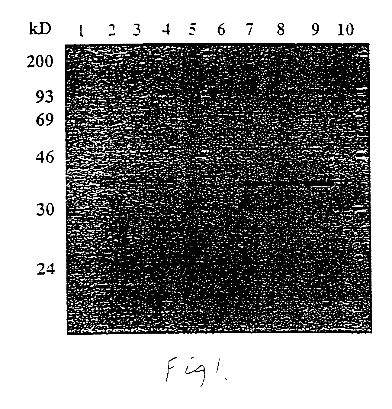 Generation of immune response to prostate-specific antigen (PSA)