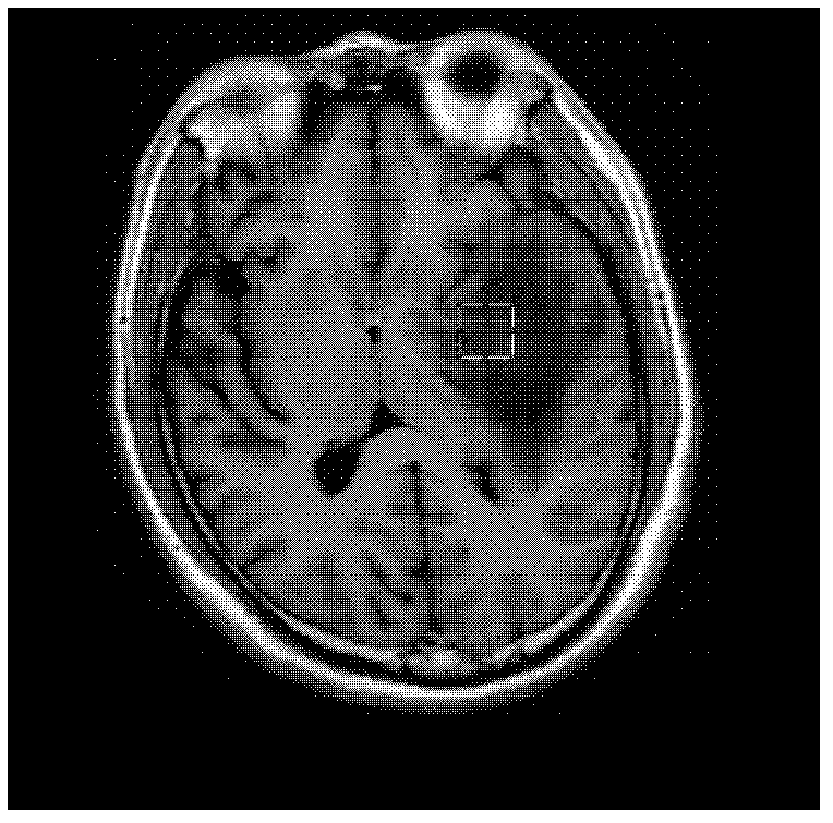 Brain tumor MIB-1 index range detection method