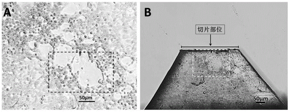 Positioning ultrathin slice method for pathologic cell infected with virus