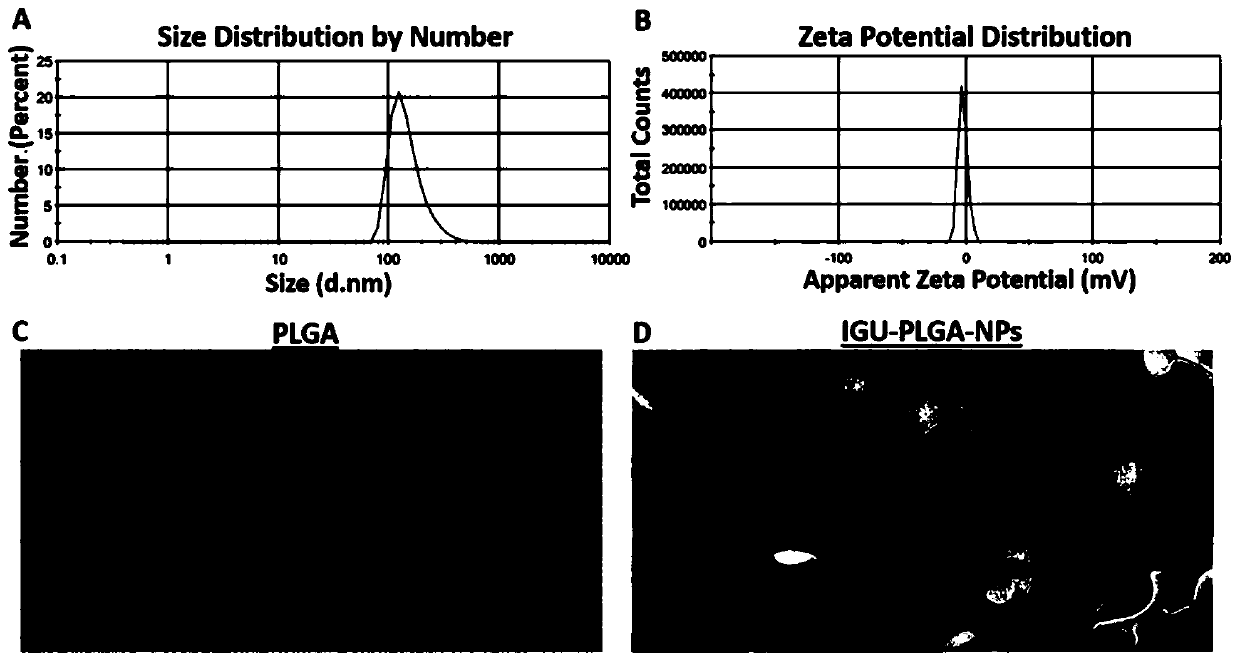 IGU-PLGA-NPs (nanoparticles) and preparation method and application thereof