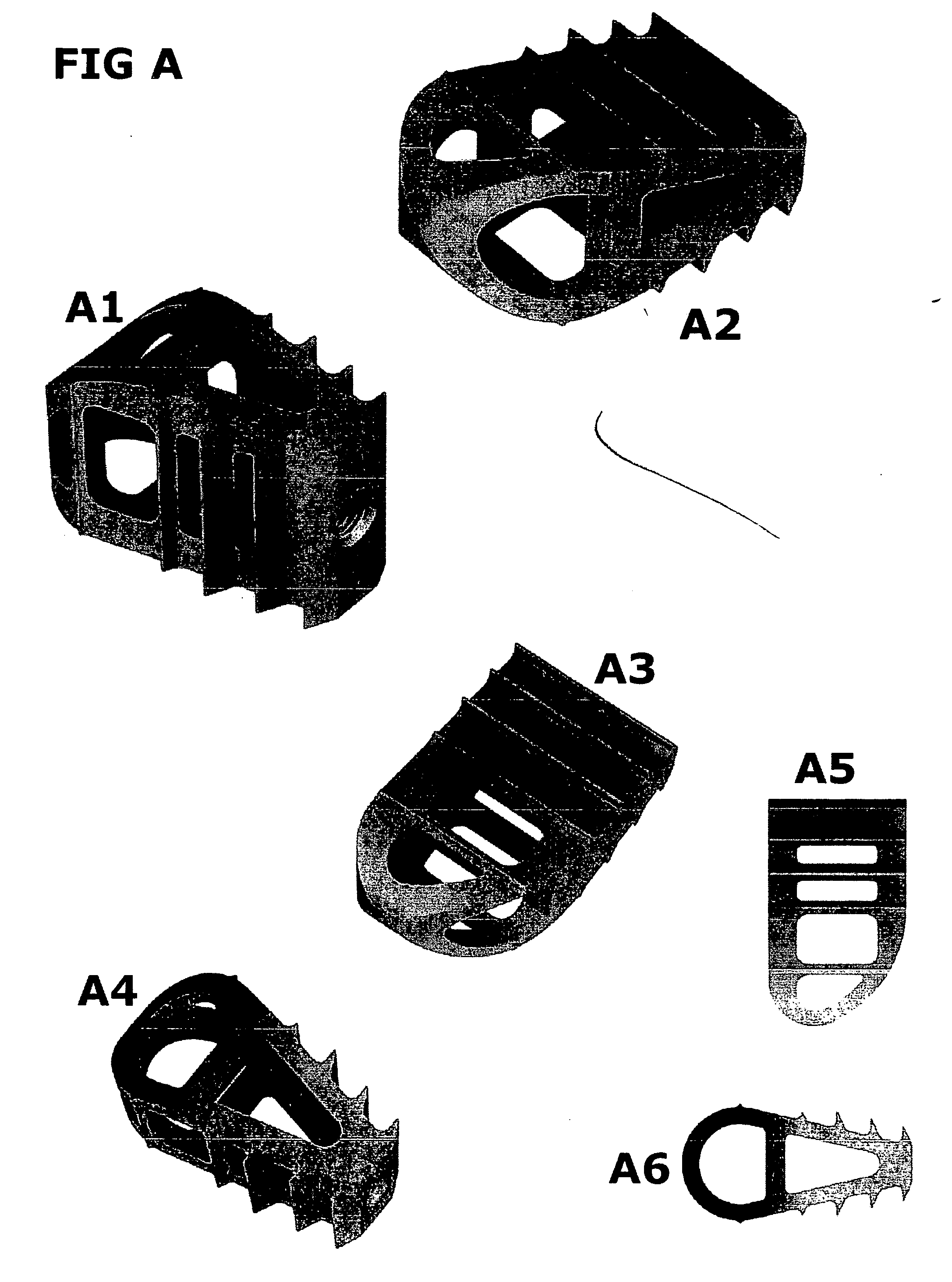 Method for correcting a deformity in the spinal column and its corresponding implant