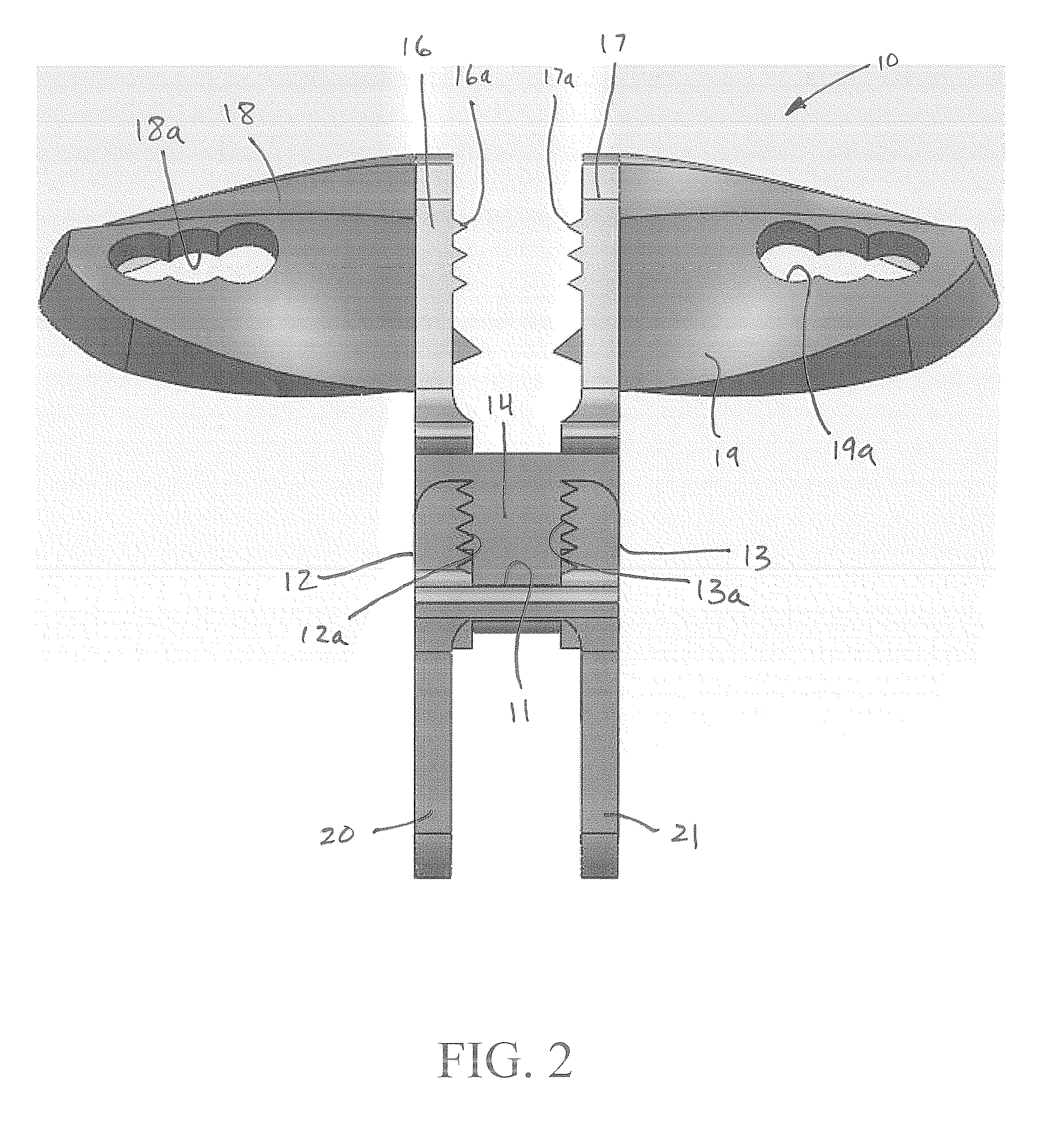 Hybrid Multifunctional Posterior Interspinous Fusion Device