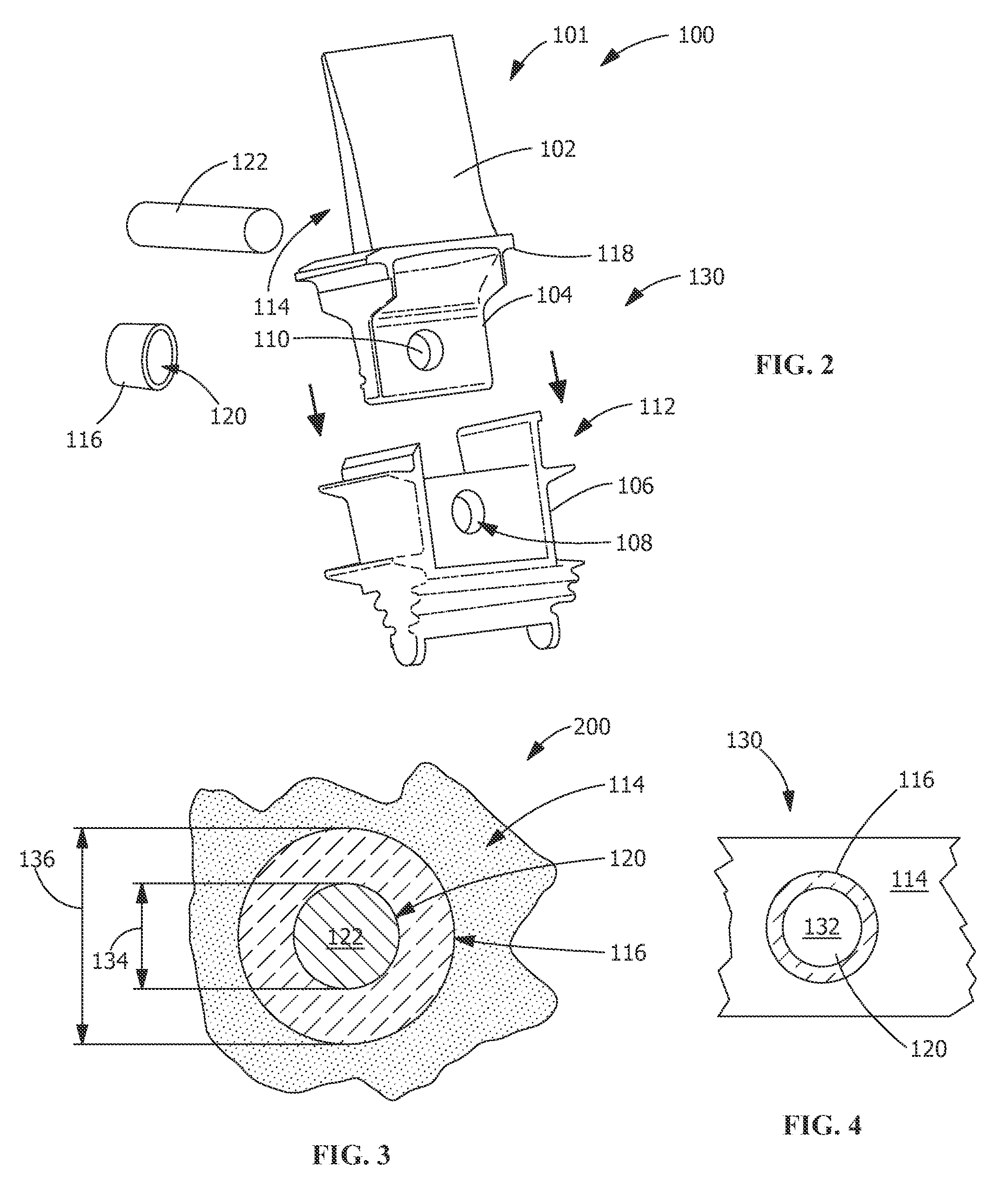Connecting system for metal components and cmc components, a turbine blade retaining system and a rotating component retaining system