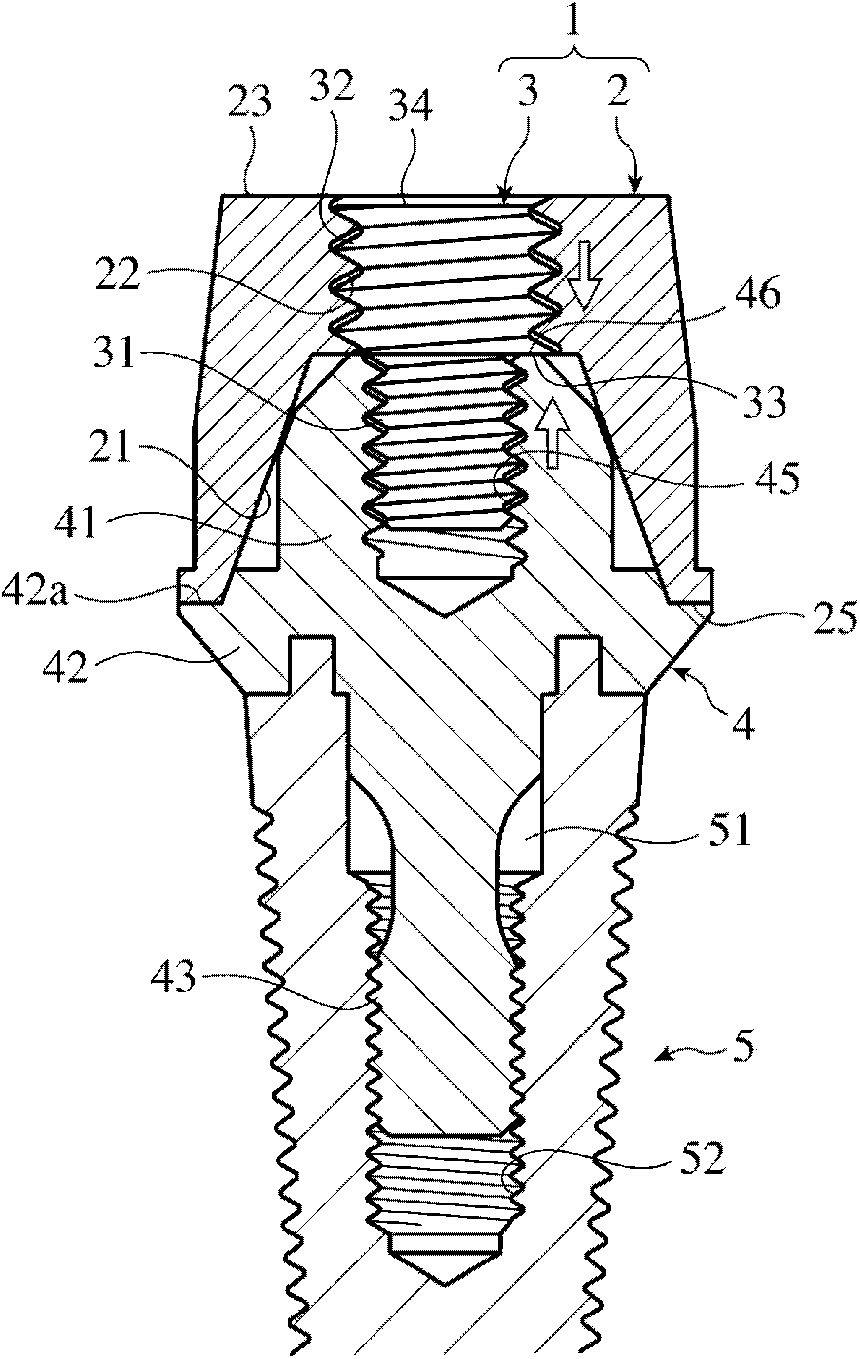 Positioner for implantation, assembly thereof, and fixing method for the positioner