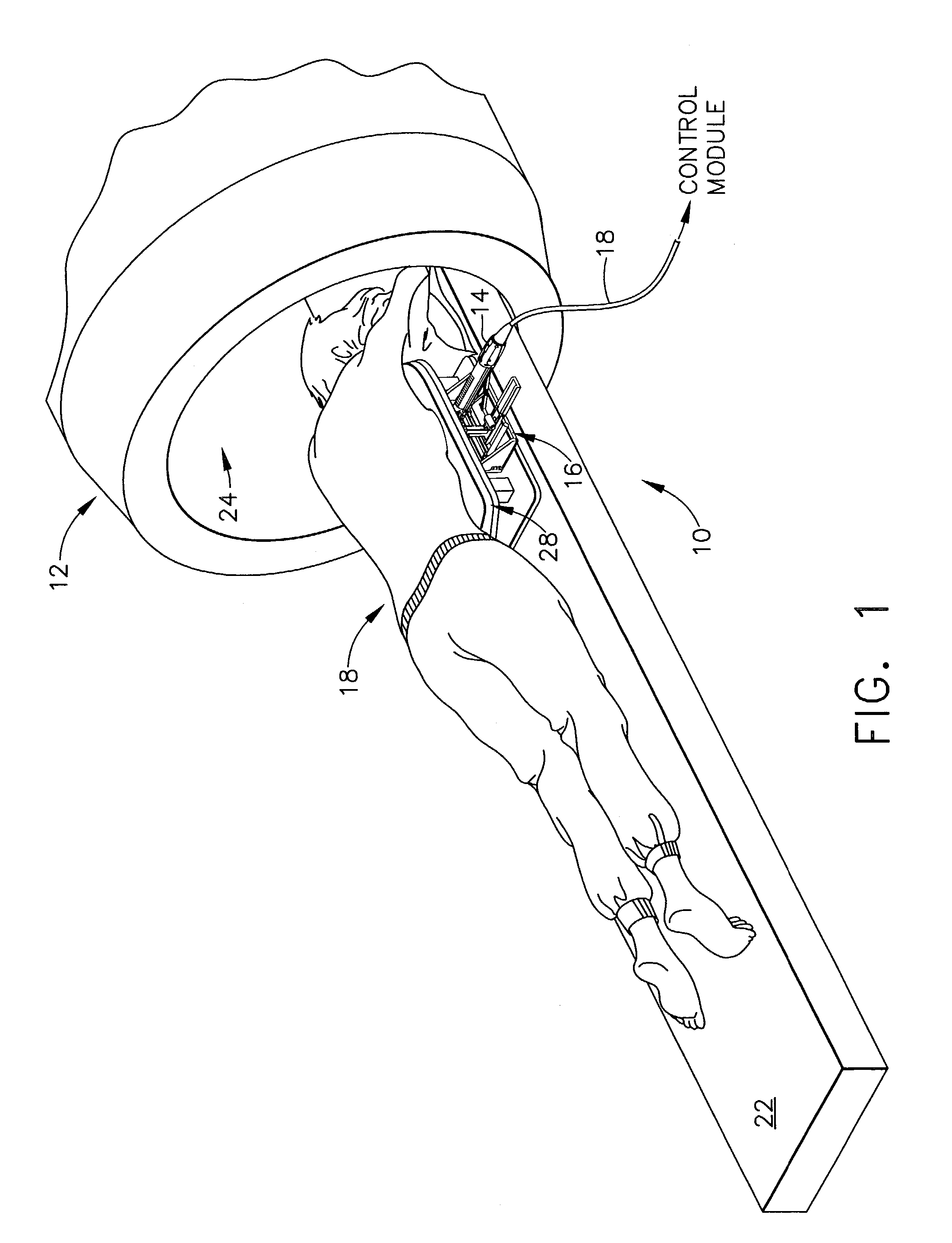 Localization mechanism for an MRI compatible biopsy device
