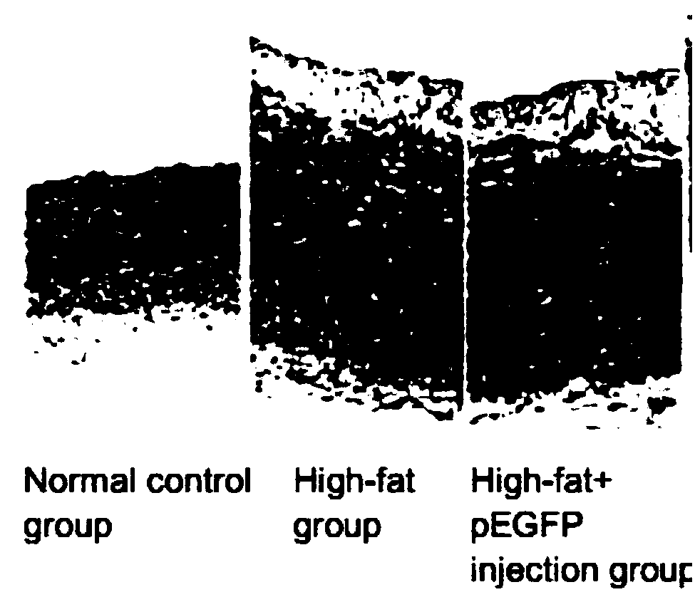 Medicine for treating coronary atherosclerosis and preparation method of medicine