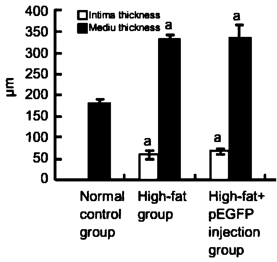 Medicine for treating coronary atherosclerosis and preparation method of medicine