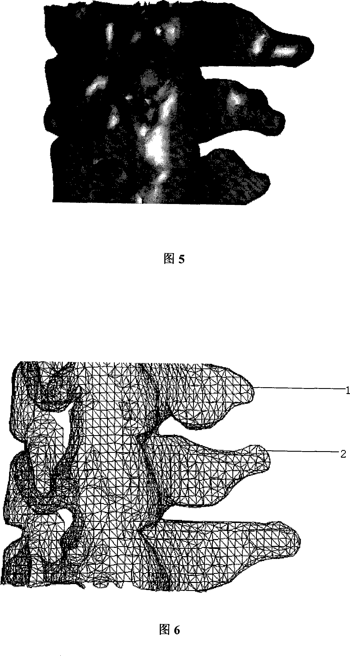 Stereo grid shaped bone filler and manufacturing method thereof