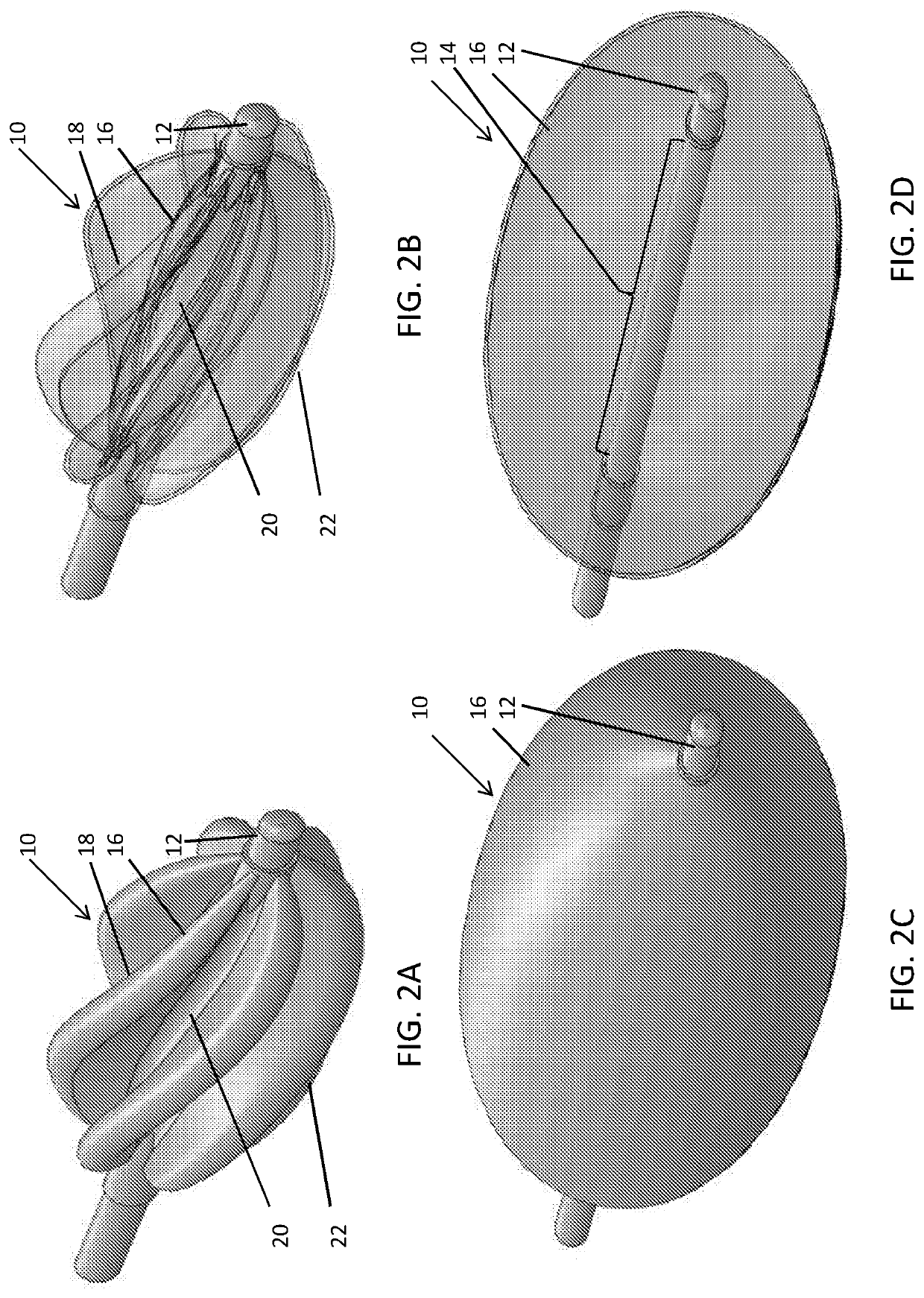Intra-aortic spiral balloon pump