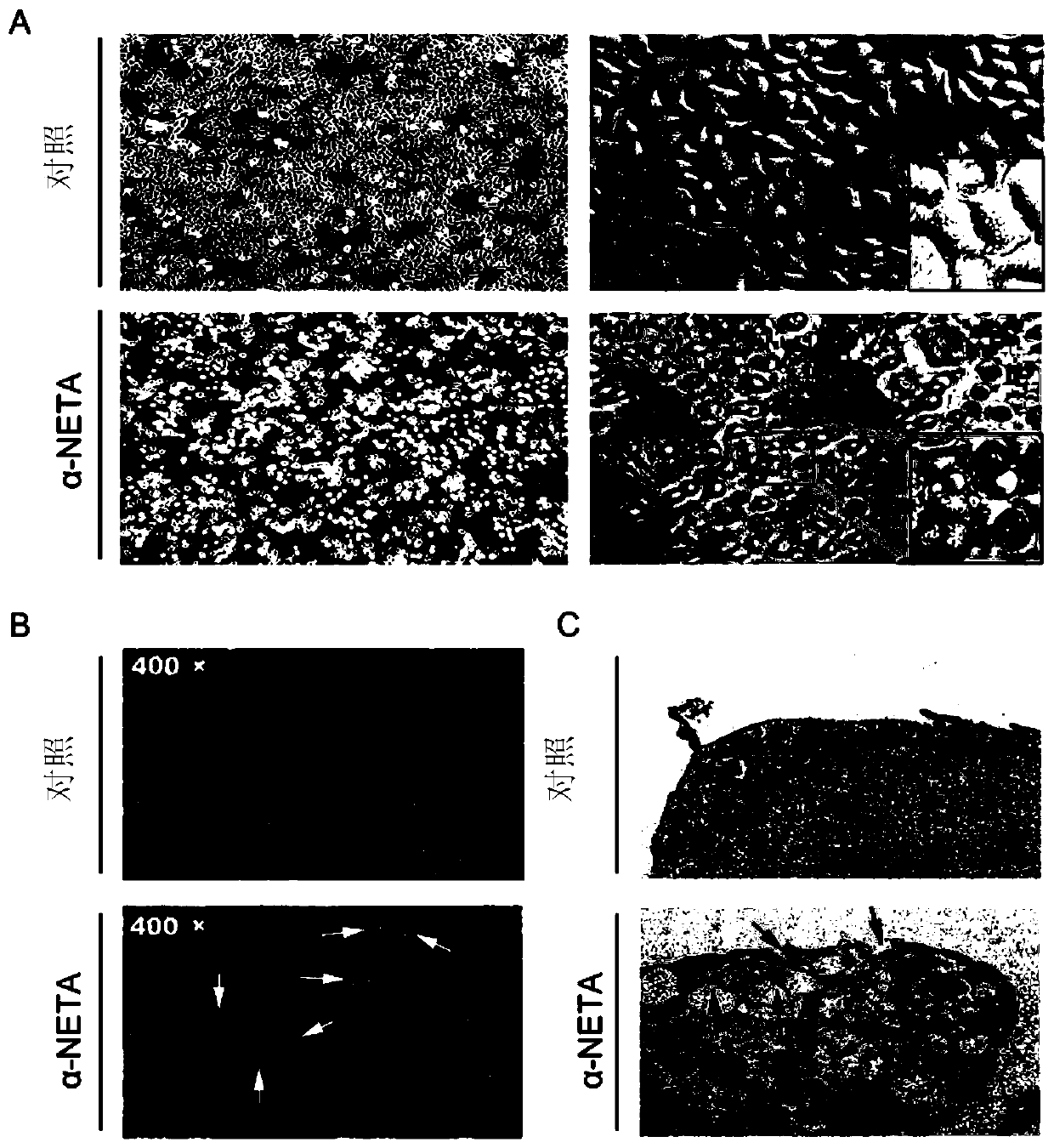 Application of alpha-NETA in induction of cell death