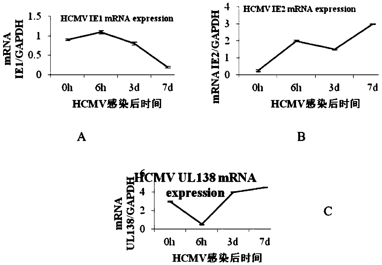 United medicine for resisting human cytomegalovirus (HCMV) and measuring method of component concentration of united medicine