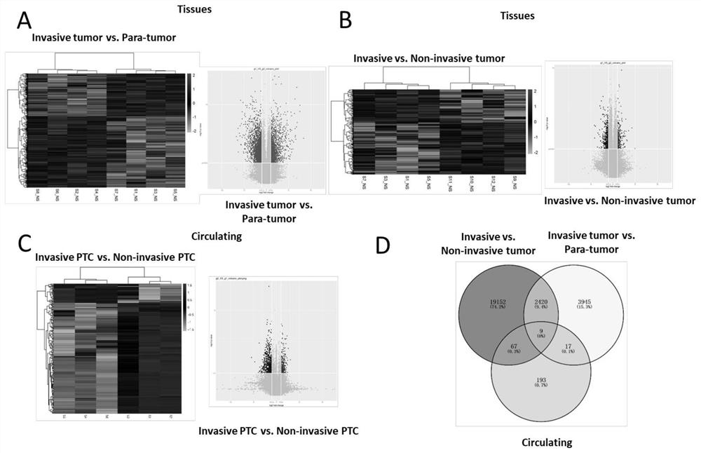 Circulating circular RNA markers and applications for the diagnosis of invasive papillary thyroid carcinoma