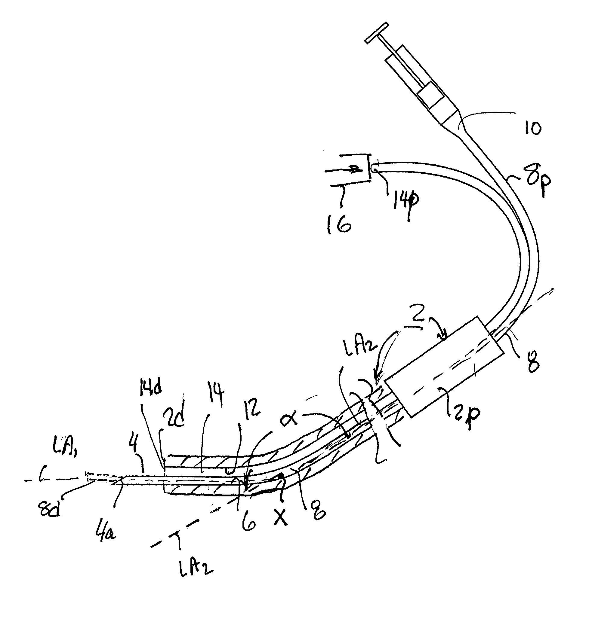 Microsurgical injection and/or distending instruments and surgical method and apparatus utilizing same