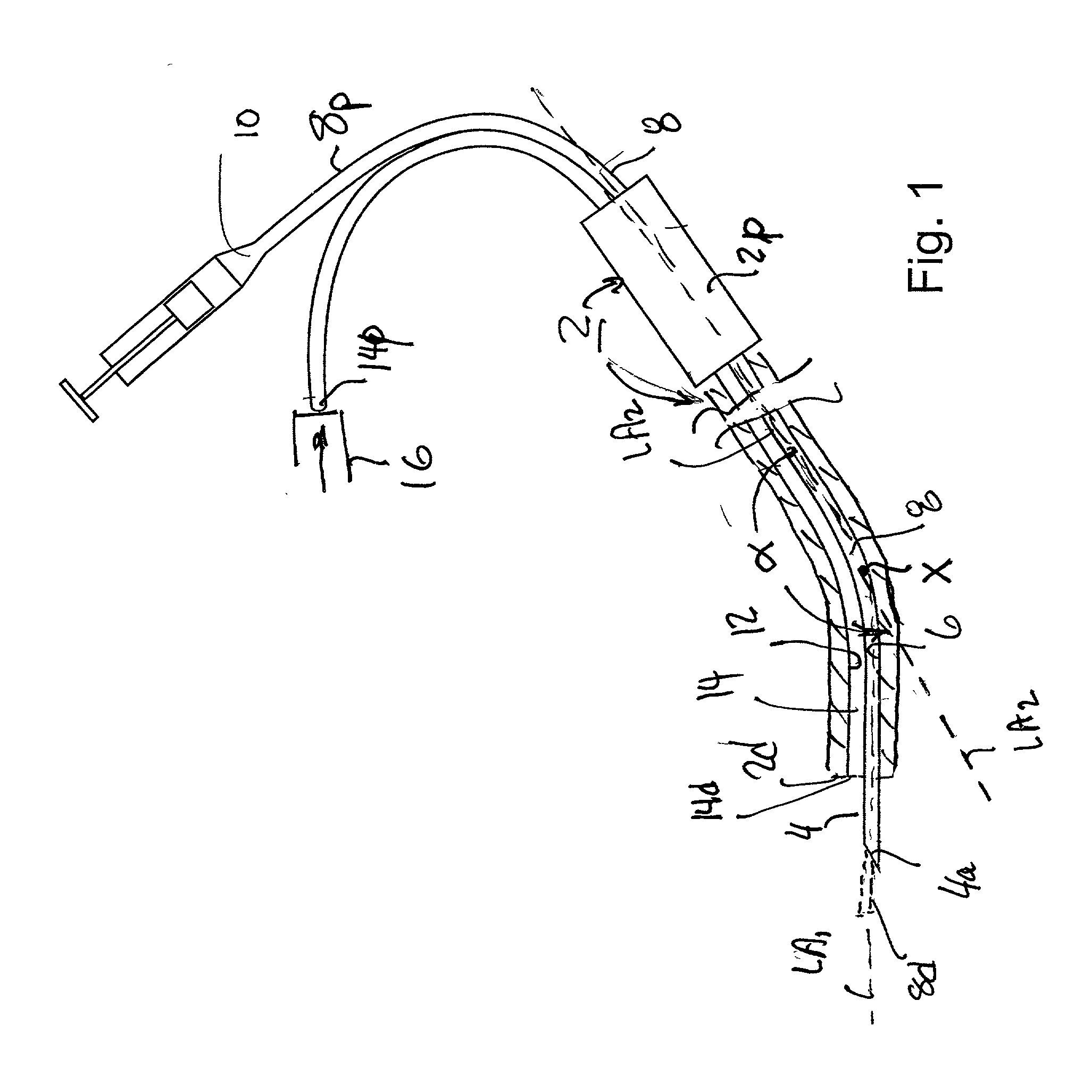 Microsurgical injection and/or distending instruments and surgical method and apparatus utilizing same