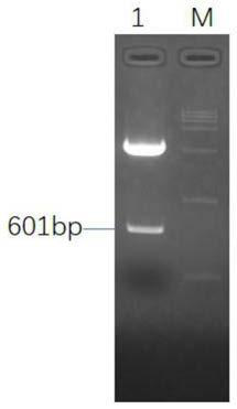 A method for preparing immunogenicity-enhanced porcine transmissible gastroenteritis s gene replication-deficient recombinant adenovirus