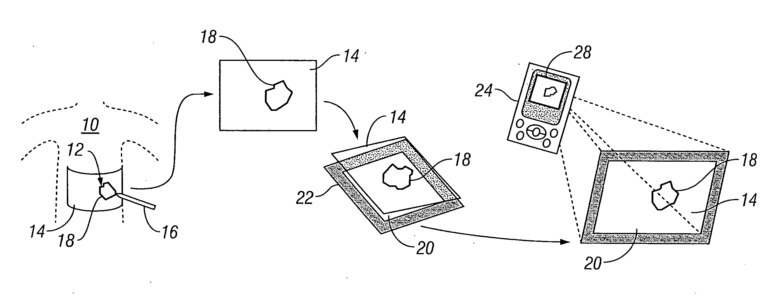 Systems and methods for wound area management