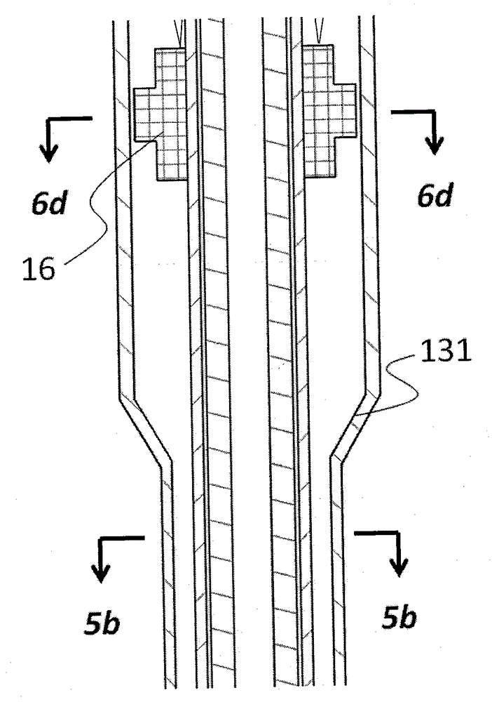 Percutaneous aorta bracket or aortic valve bracket system with far-end protection