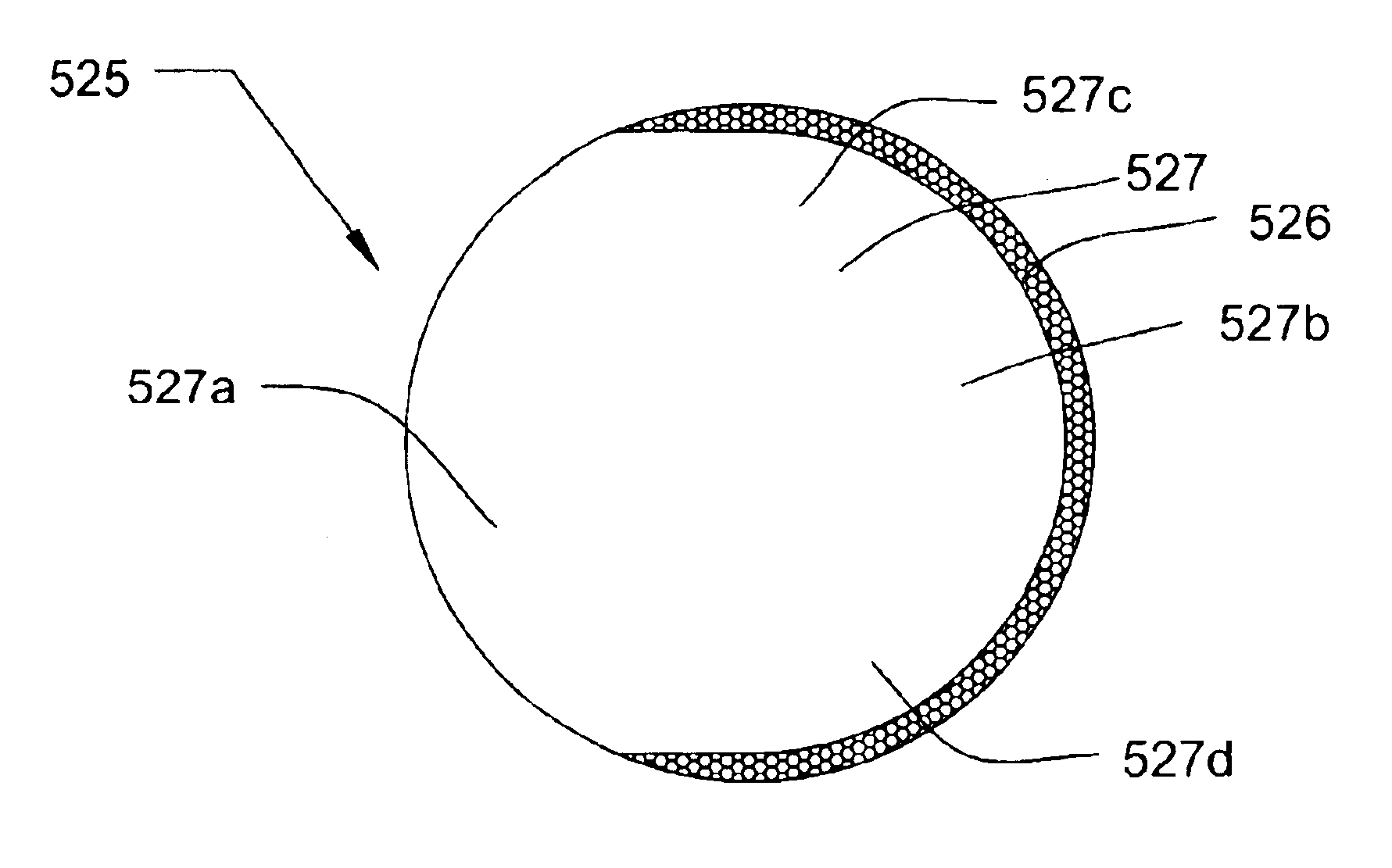 Prosthetic joint component having at least one solid polycrystalline diamond component