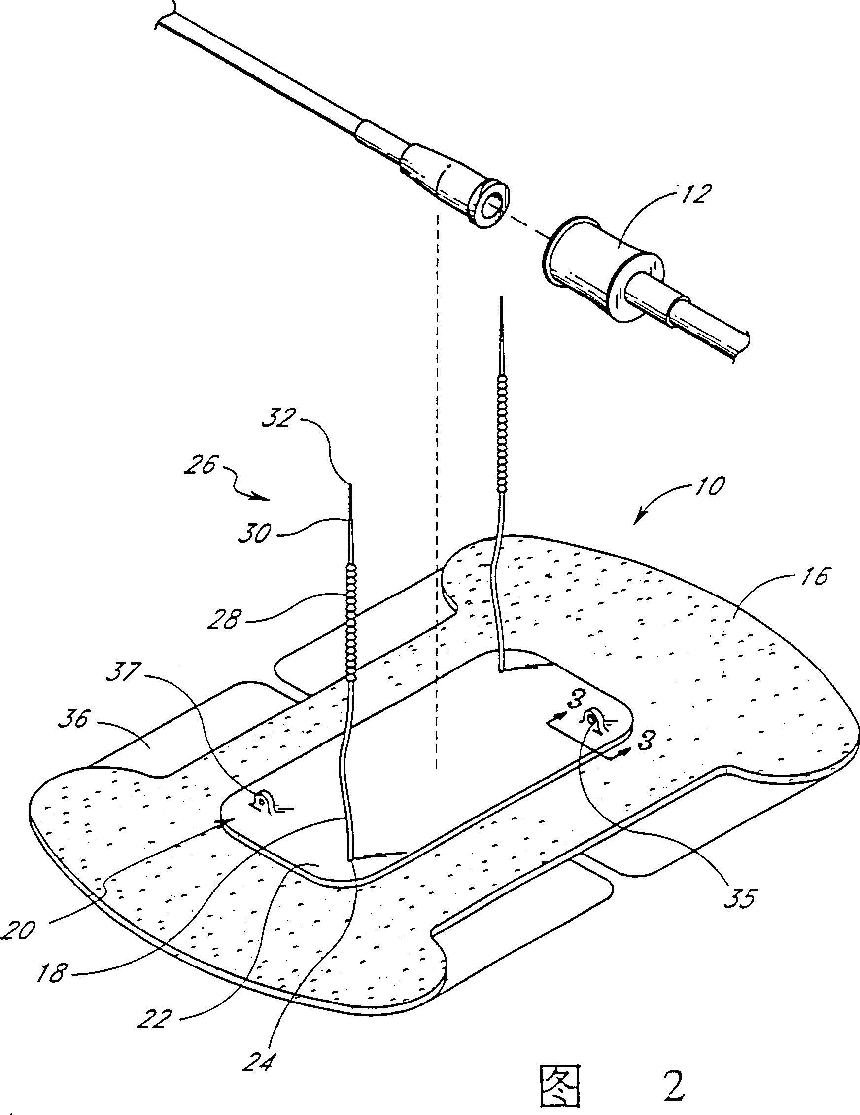 Cathether securement device