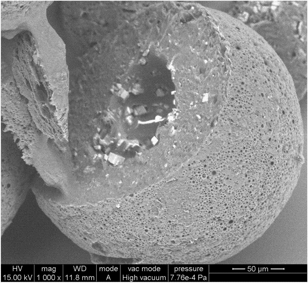 PLGA(polylactic-co-glycolic acid)/hydroxyapatite/calcium carbonate compound microspheres and preparation method thereof