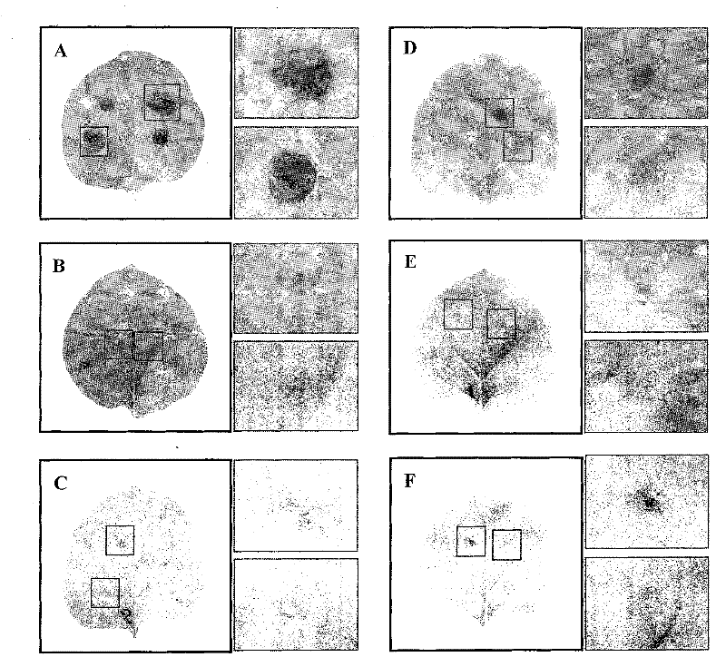 Novel cotton fungal disease-resistant gene GhMPK7 and application thereof