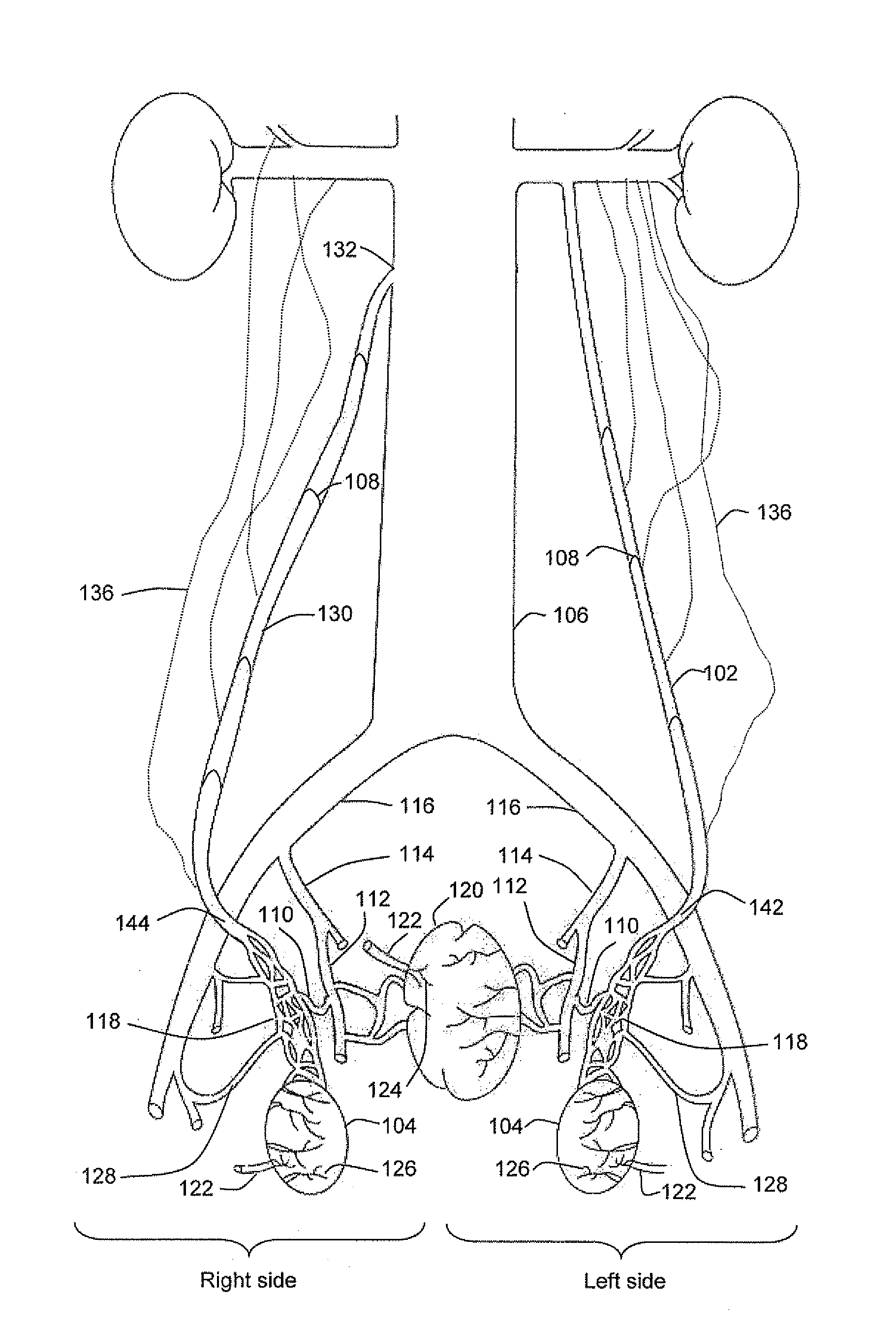 Diagnosis and treatment of varicocele and prostate disorders