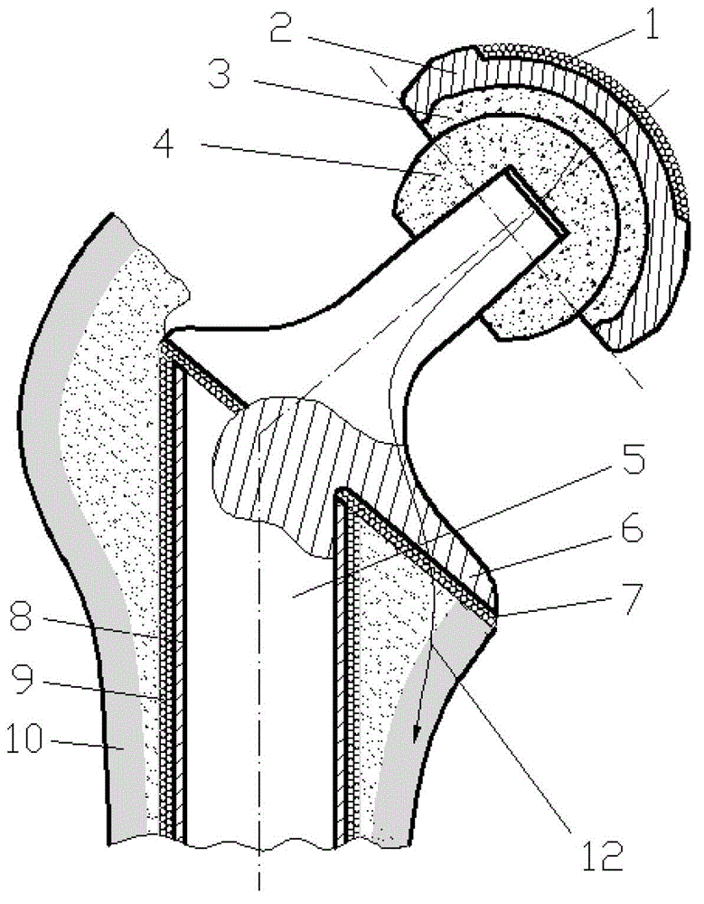 Novel artificial hip joint and manufacturing method thereof