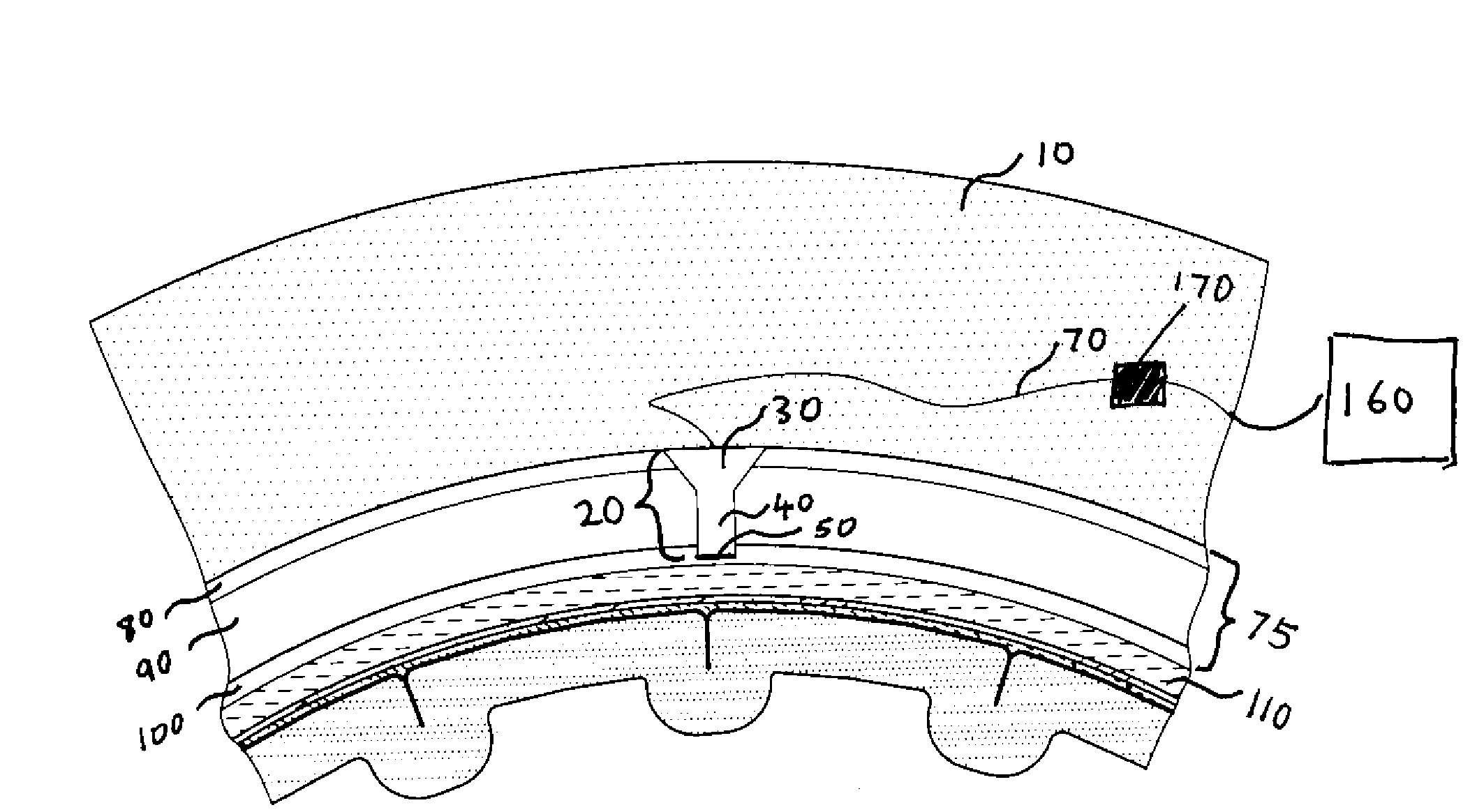 Methods and Systems for Using Intracranial Electrodes
