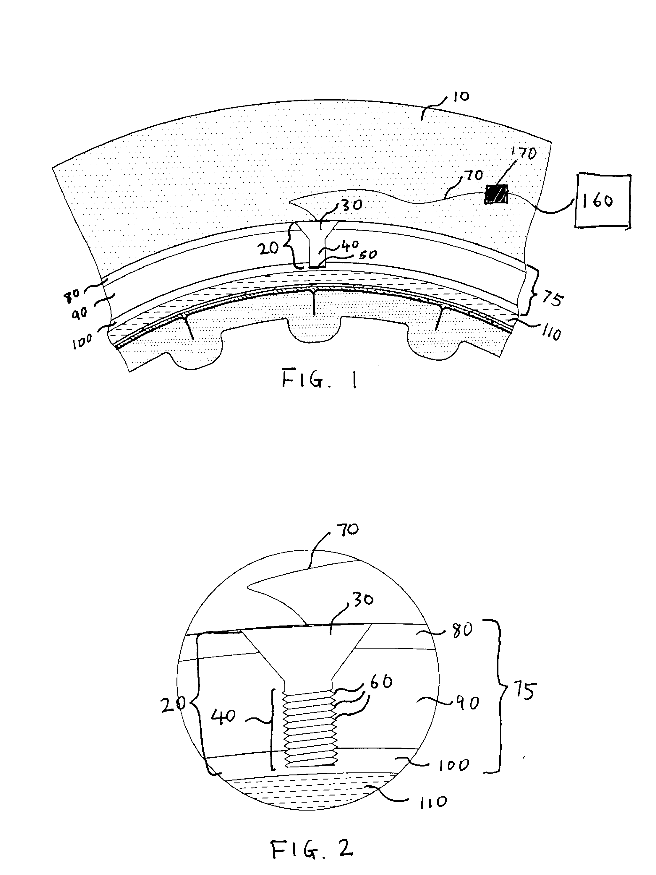 Methods and Systems for Using Intracranial Electrodes