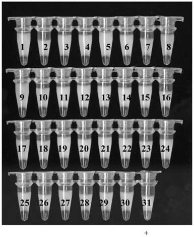 Lamp kit for detecting vanb gene and its special primers