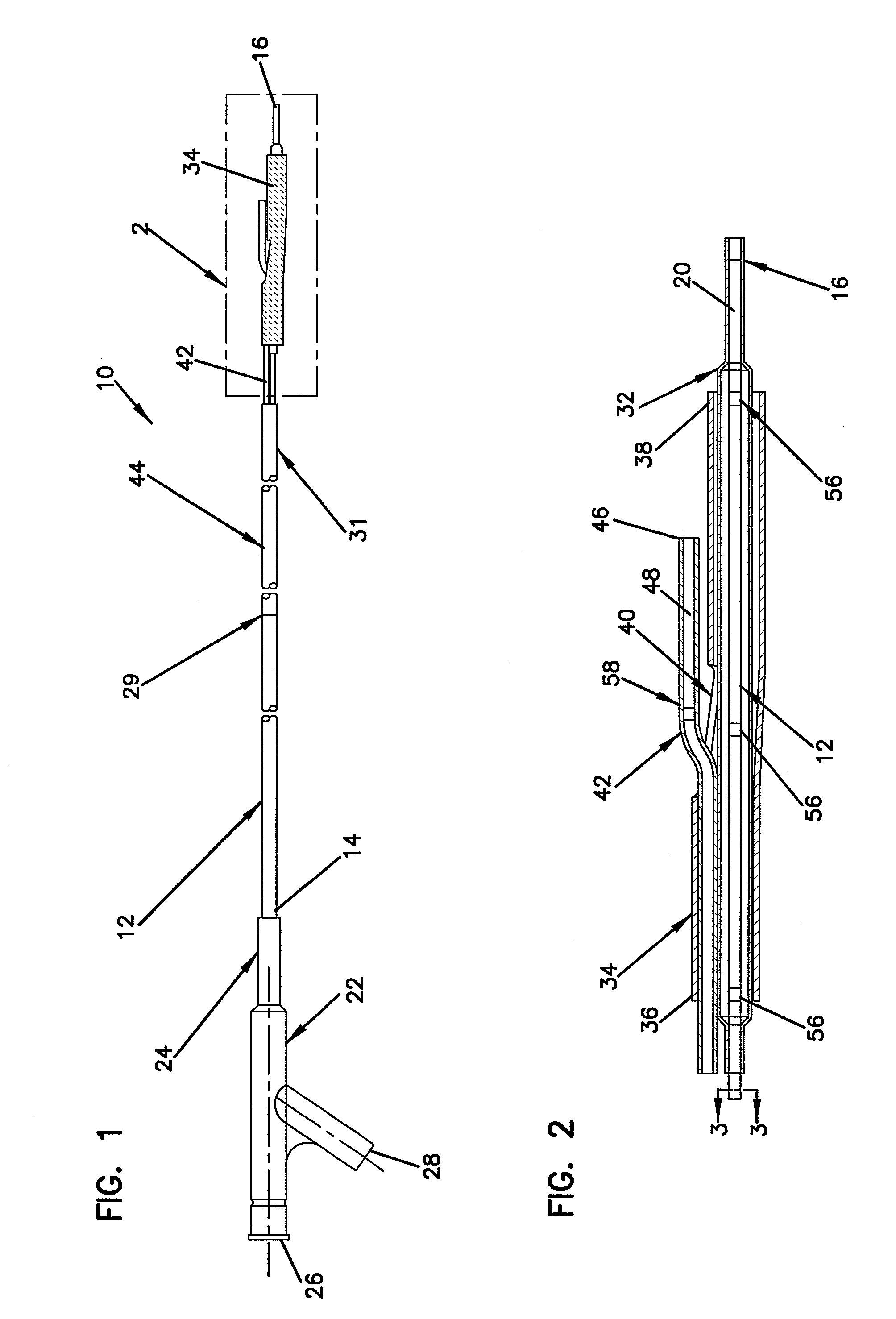 Short sleeve stent delivery catheter and methods