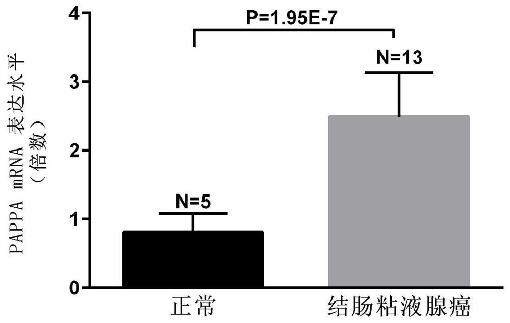 Biomarkers for the detection of colorectal cancer and their applications