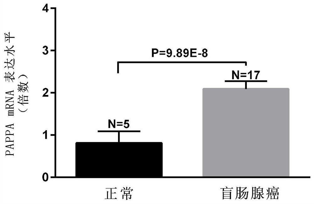 Biomarkers for the detection of colorectal cancer and their applications