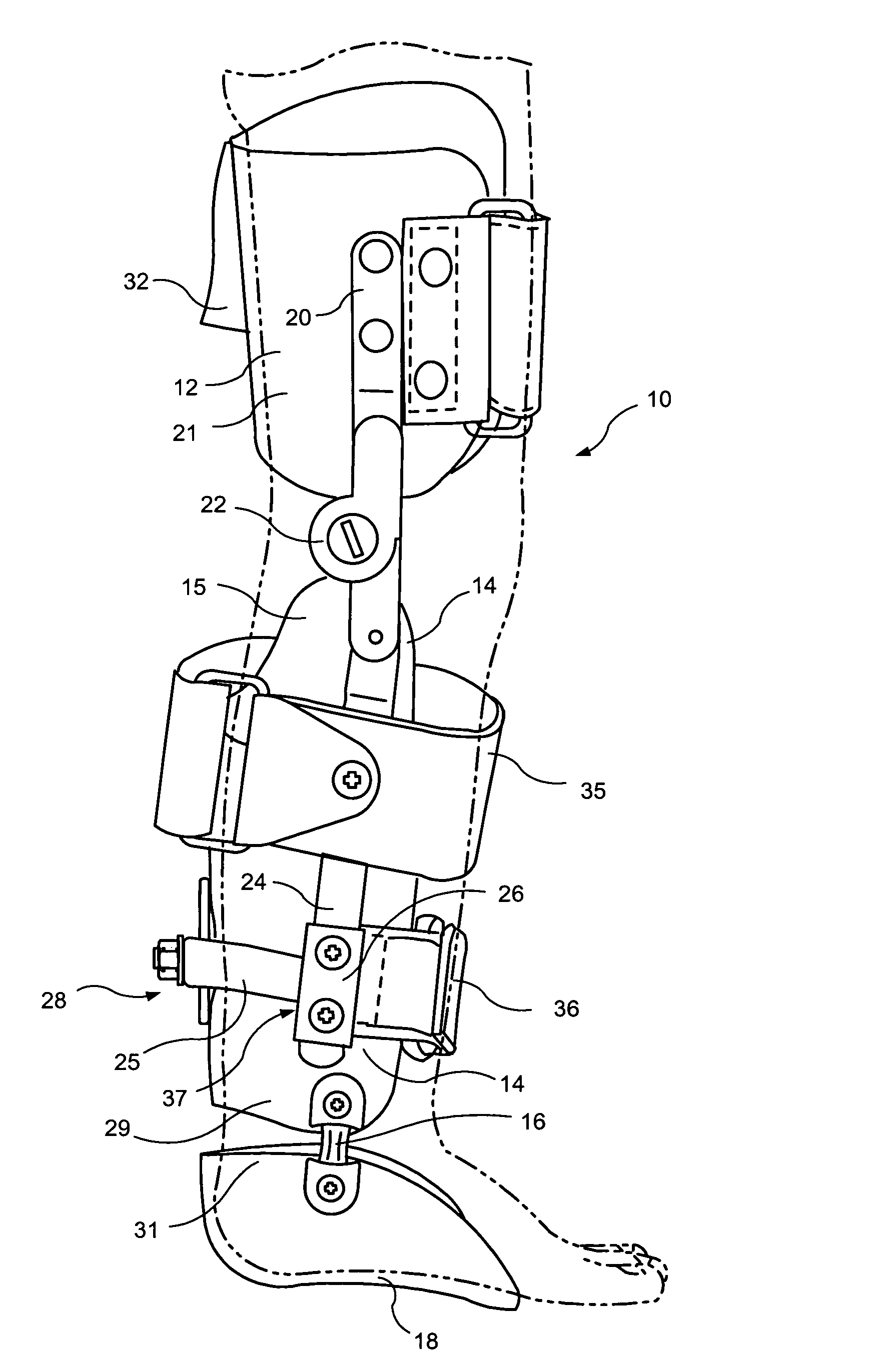 Apparatus for correction of leg deformities