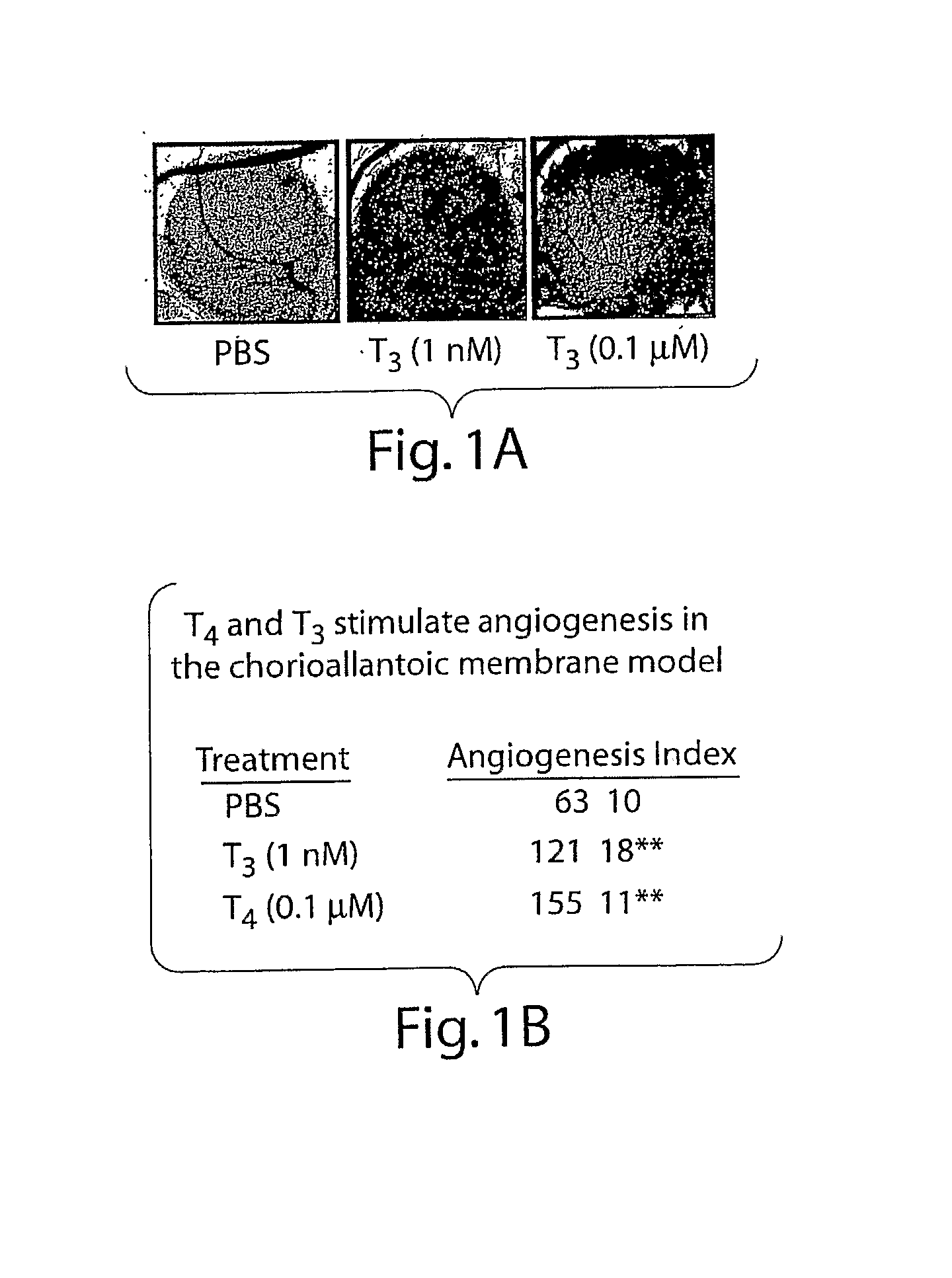 Thyroid Hormone Analogs and Methods of Use