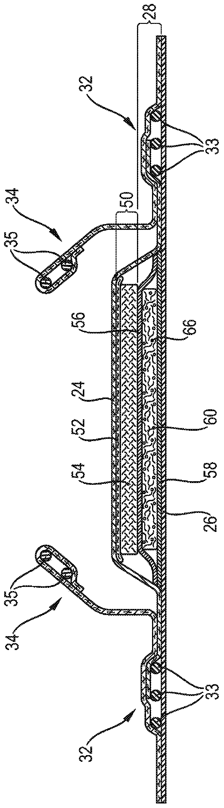 Agglomerated superabsorbent polymer particles comprising clay platelets with edge modification and/or surface modification