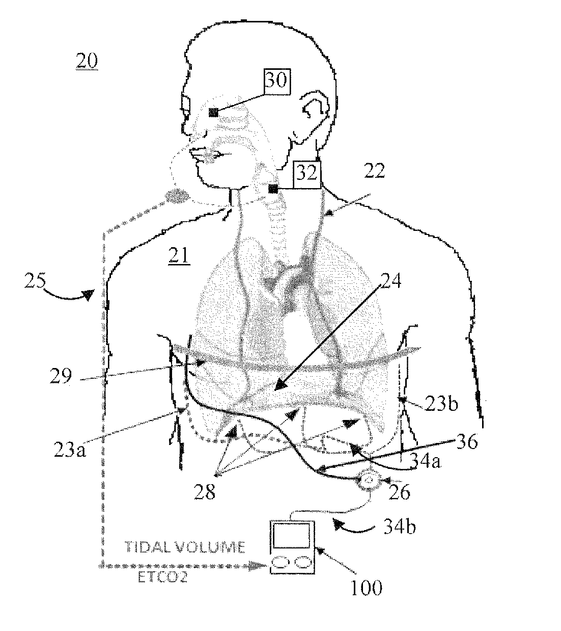 System and method for neuromorphic controlled adaptive pacing of respiratory muscles and nerves