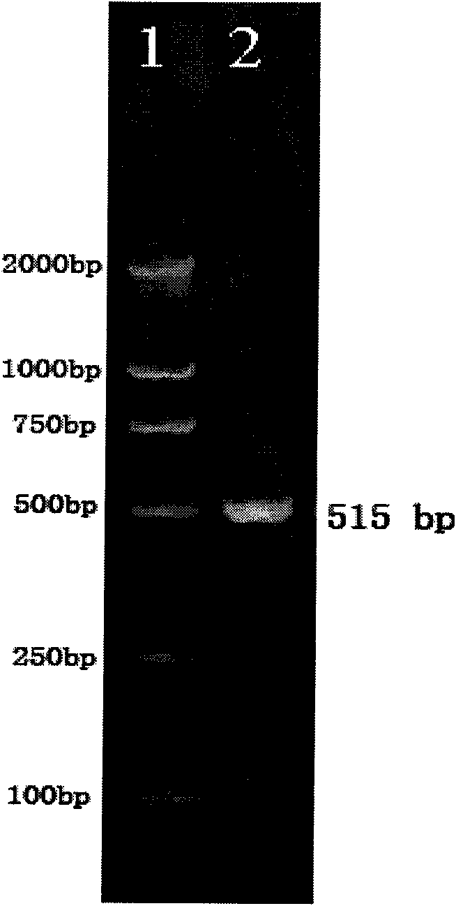 Method for fast detecting reverse transcription-polymerase chain reaction of paralichthys rhabdovirus