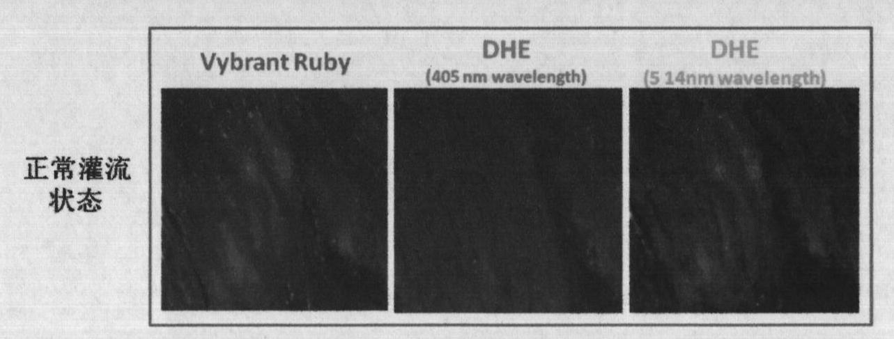 Detection method for isolated perfusion heart active oxygen and mitochondrial membrane potential