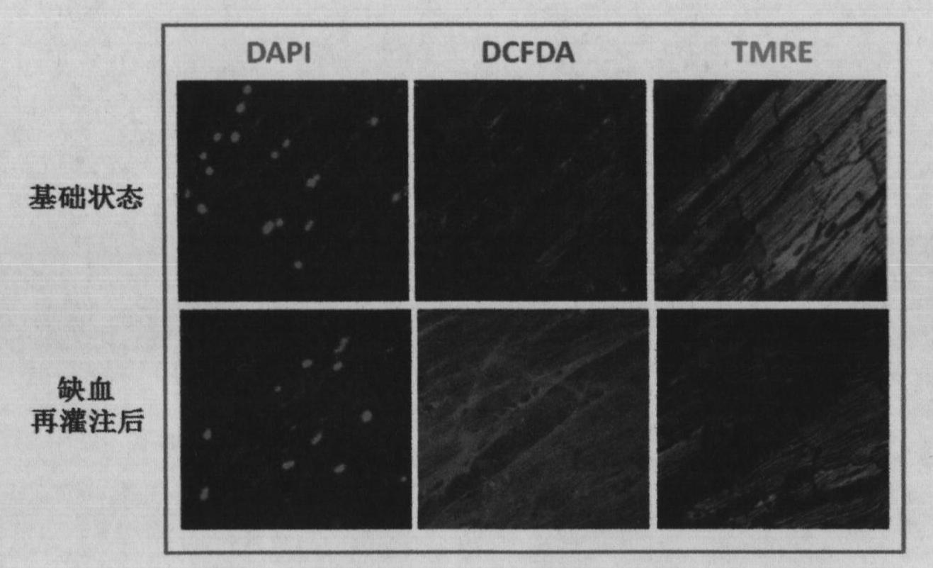 Detection method for isolated perfusion heart active oxygen and mitochondrial membrane potential