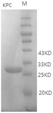 Anti-KPC type carbapenemase hybridoma cell strain, monoclonal antibody and application