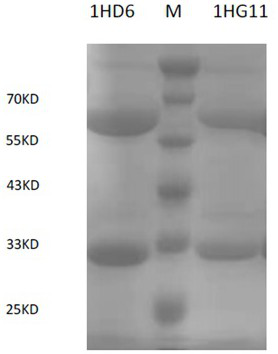 Anti-KPC type carbapenemase hybridoma cell strain, monoclonal antibody and application