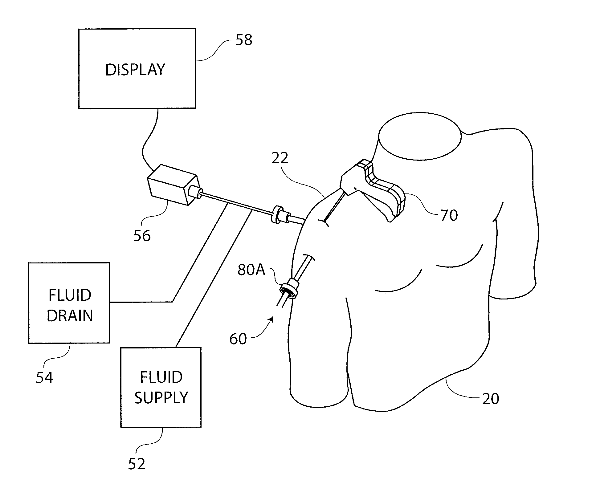 Guidewire having a distal fixation member for delivering and positioning sheet-like materials in surgery