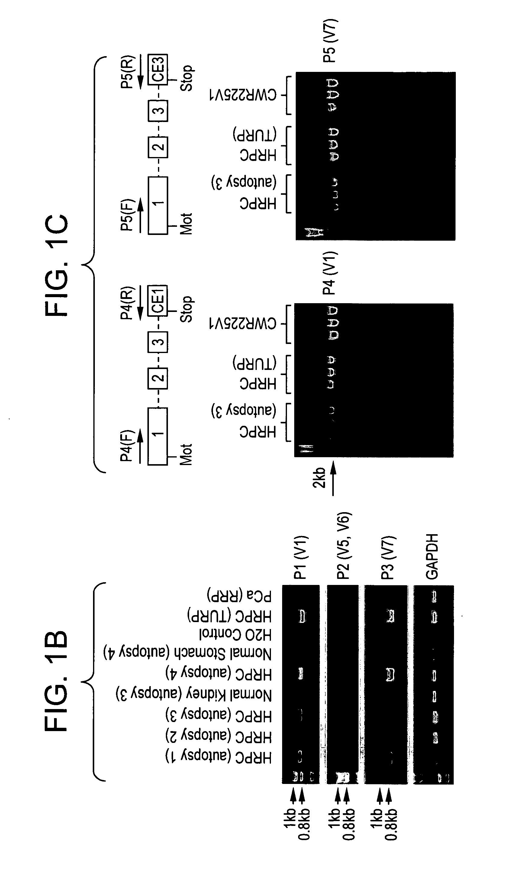 Compositions and methods for treating or preventing prostate cancer and for detecting androgen receptor variants