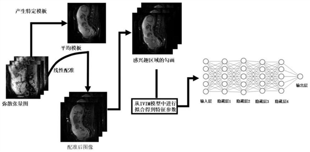 Intra-voxel incoherent motion imaging acceleration method and device based on deep learning