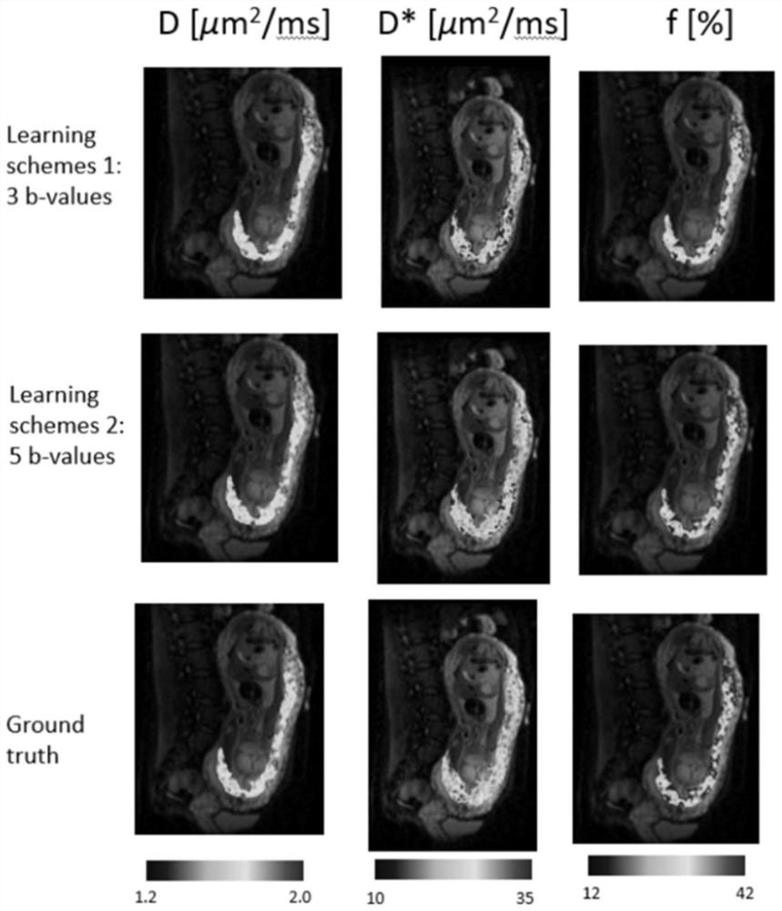 Intra-voxel incoherent motion imaging acceleration method and device based on deep learning